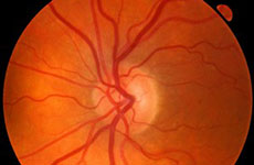 Ophthalmology & Visual Sciences